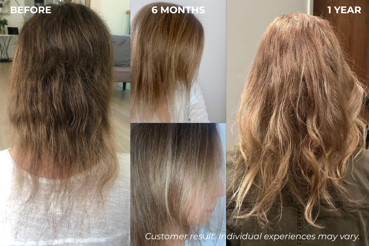 Customer hair before and after daily Zivolife use